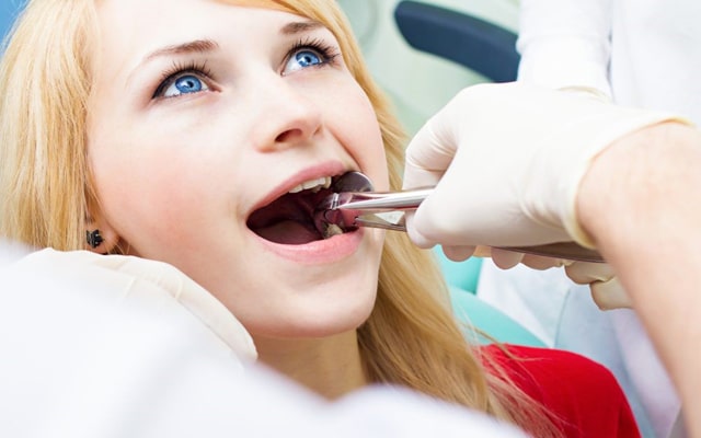 All You Want to Know About Wisdom Teeth Removal and Its Cost